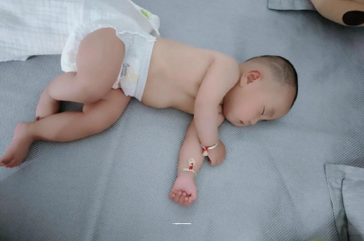 明港宝宝褶皱处擦粉还是油